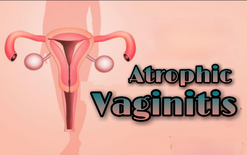 an-overview-of-atrophic-vaginitis-platform-cme