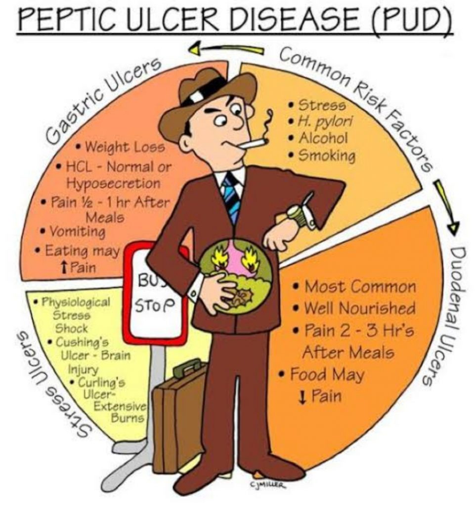 a-brief-overview-of-peptic-ulcer-disease-use-of-anti-ulcer-drugs