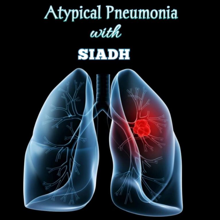 Atypical Pneumonia With SIADH: Diagnosis To Treatment ।। হাবিজাবি ৫৮ ...