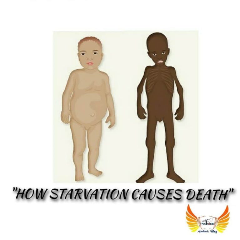 how-starvation-causes-death-platform-cme