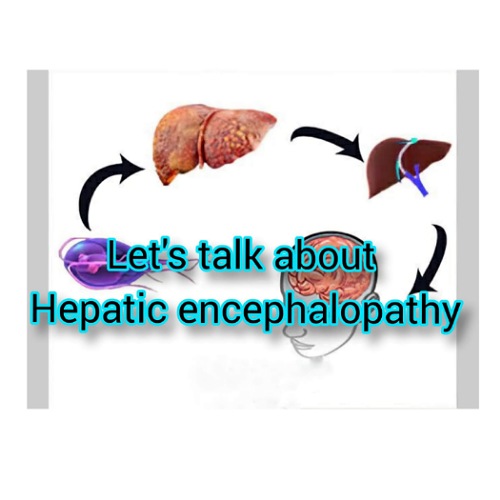Let’s Talk about Hepatic Encephalopathy – Platform | CME